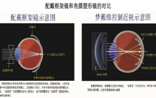 非球面单光高清膜怎么用，非球面单光高清膜怎么用的