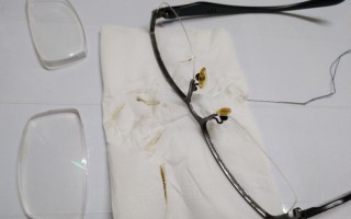 隐形眼镜坏掉是怎么样，隐形眼镜坏掉是怎么样的