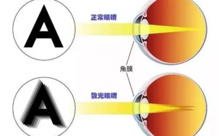 高散光眼镜多少钱一副，高散光眼镜多少钱一副啊